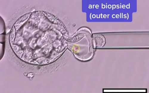 合肥大学生供卵包|合肥三代试管婴儿费用多少？