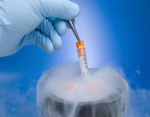 Tlg40_重度弱精症做二代试管移植生的孩子健康吗？