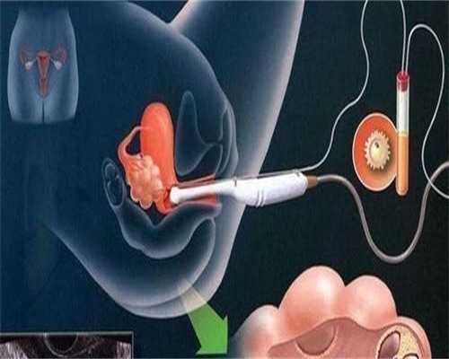 合肥代孕的费用 合肥试管婴儿成功率有多少?什么情况做试管成功率高? ‘孕