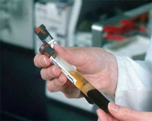 合肥生殖中心私立医院 合肥做试管最好的医院?试管婴儿的平均价格是多少?