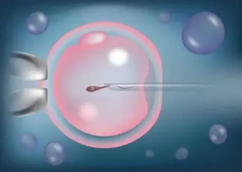 南昌合法代孕机构_L52q1_vA8n0_39643_瑞白上午打还是下午打好？_5C21Q