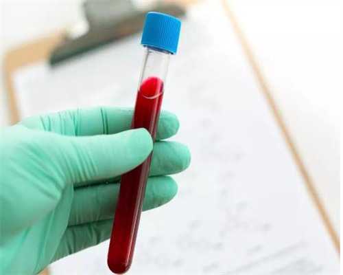 羊水穿刺补贴2000到哪里领？