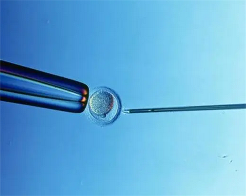 一对地贫夫妇的健康宝宝_z70RR