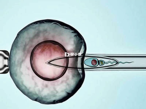 试管婴儿或者代孕的孕妈妈为什么会去做亲子鉴定？