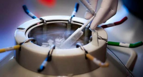 安庆输卵管积水能做试管婴儿吗三代试管技术可避免遗传