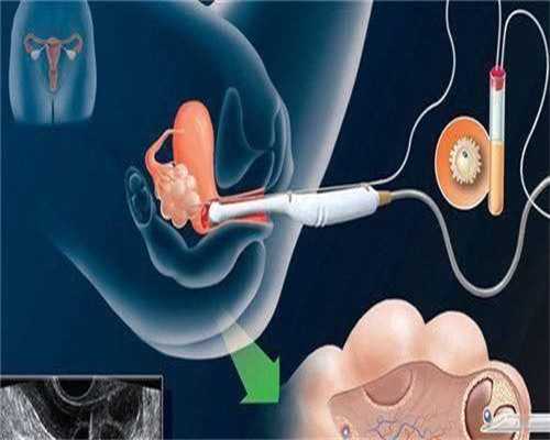 合肥代孕较好医院 合肥安医试管婴儿怎么样？试管婴儿跟普通婴儿有差别么？