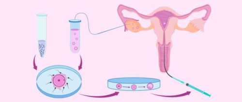 代生代生便宜_代生技术成功率|石家庄试管中介应该怎么找-试管助孕机构