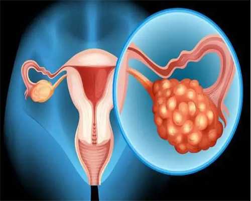 专业代怀多少钱_代怀代生靠谱吗_兰州供卵试管婴儿费用,兰州试管婴儿捐卵供卵