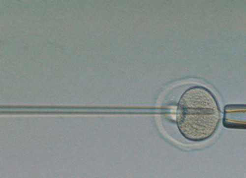 找人代怀价格_有没有代怀的_鹤岗做一次试管婴儿术前检查到胚胎移植需要多少