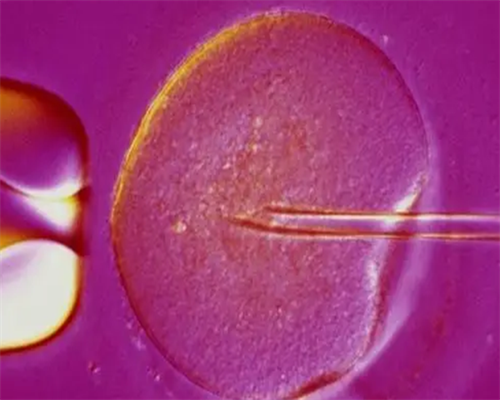 合肥助孕借种生子 合肥做试管婴儿的医院 ‘b超单哪里能看出是男是女’