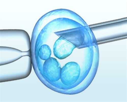 代妈费用_53岁借卵子生子|2026
钦州试管婴儿医院排名，附成功率及费用介绍